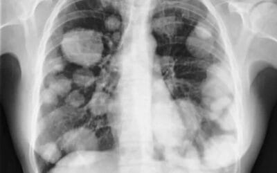 VAPEAR, UN RIESGO BANALIZADO